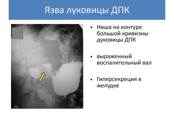 Kraken торговая площадка ссылка